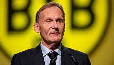 Ватцке назвал игру «Боруссии» с «Баварией» как никогда особенной