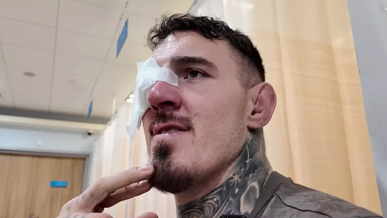 Отец Аспиналла рассказал о состоянии сына после тычка в глаз от Гана